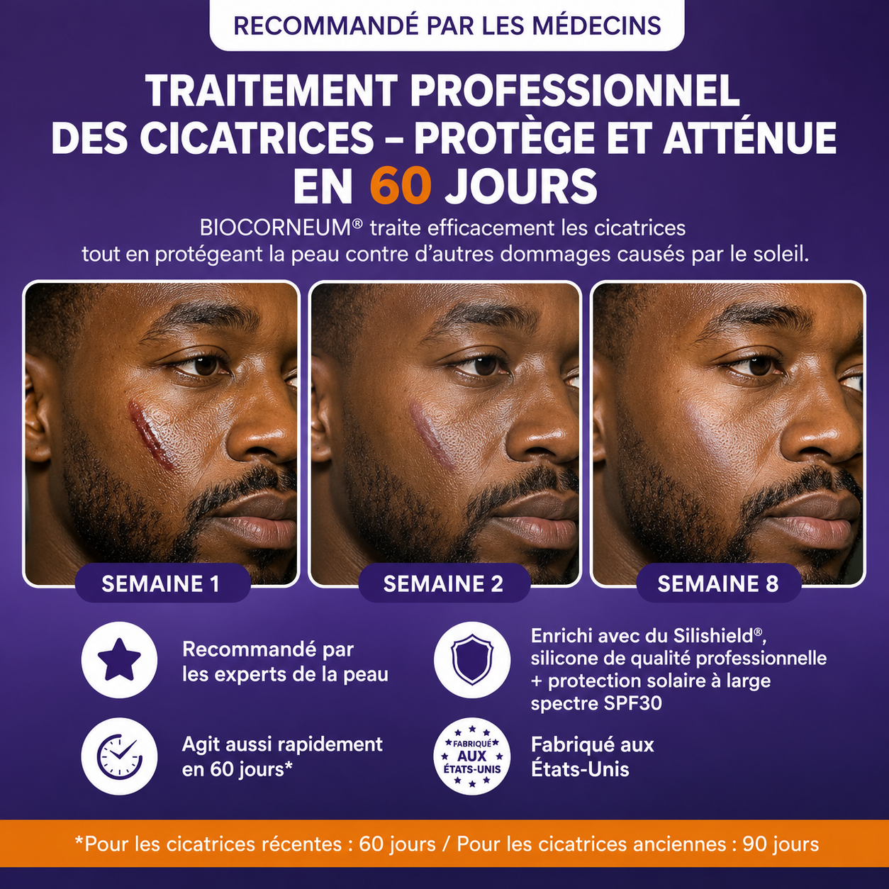 BioCorneum – Traitement des Cicatrices avec SPF 30