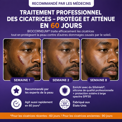BioCorneum – Traitement des Cicatrices avec SPF 30