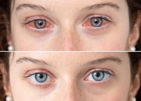 Complément Naturel pour le Confort des Yeux