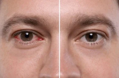 Complément Naturel pour le Confort des Yeux