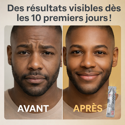 Zooone - Supplément NAD nicotinamide riboside