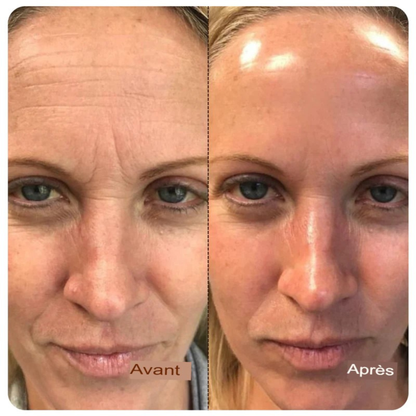 Ampoule liftante au collagène profond et aux peptides de soie-Lift Instantané et Éclat Naturel