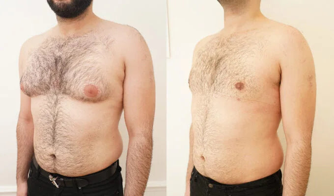 capsules de testostérone turkestérone tongkat ali