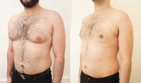 capsules de testostérone turkestérone tongkat ali