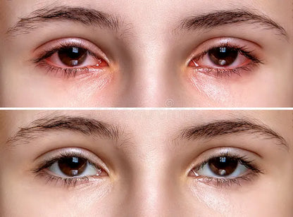 Capsules pour la santé oculaire 15-en-1 avec lutéine